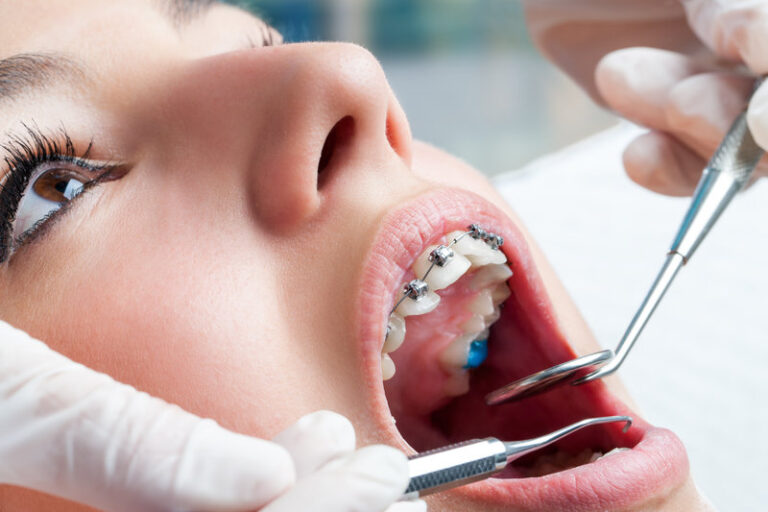 Dental Care Slough, Slough Dental Care & Dentist In Slough: A Complete Guide for Healthier Smiles